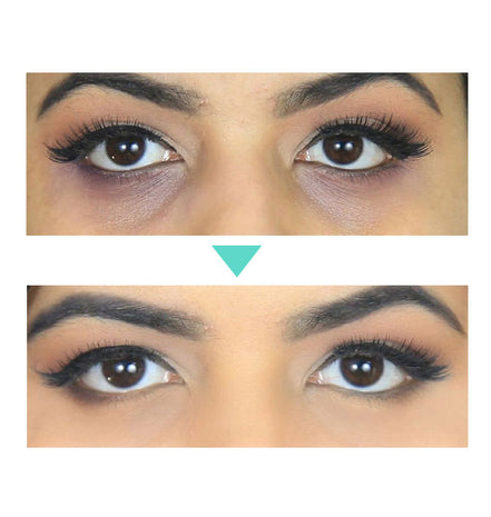 🧴AgeLift™ Peptide Eye Cream (30ML)