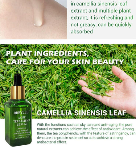 🌿ClearSkin™ Acne Repair Serum Oil
