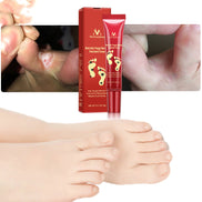 🦶 SAY GOODBYE TO DRY, CRACKED, PAINFUL FEET CREAM