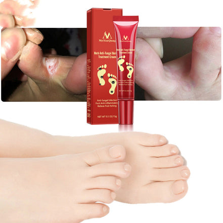 🦶 SAY GOODBYE TO DRY, CRACKED, PAINFUL FEET CREAM