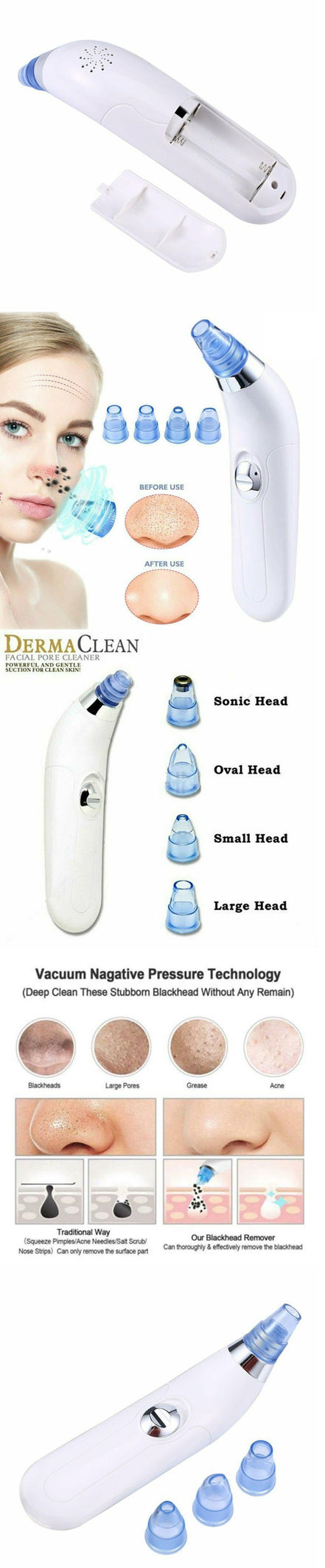 🧴DeepClean™ Electric Blackhead Remover Pore Vacuum – Spa-Grade Acne & Pore Cleansing Device