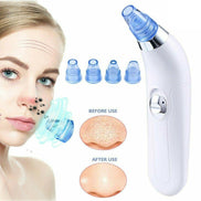 🧴DeepClean™ Electric Blackhead Remover Pore Vacuum – Spa-Grade Acne & Pore Cleansing Device