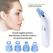 🧴DeepClean™ Electric Blackhead Remover Pore Vacuum – Spa-Grade Acne & Pore Cleansing Device