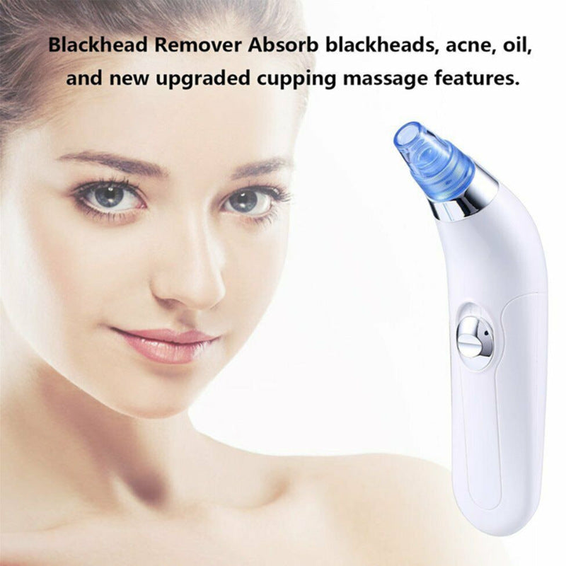 🧴DeepClean™ Electric Blackhead Remover Pore Vacuum – Spa-Grade Acne & Pore Cleansing Device