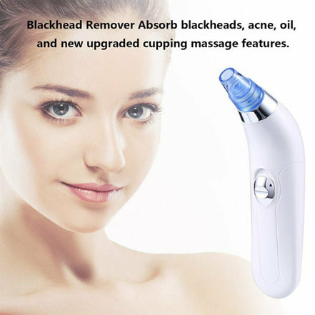 🧴DeepClean™ Electric Blackhead Remover Pore Vacuum – Spa-Grade Acne & Pore Cleansing Device