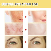 🐌Snail Collagen Glow Serum – Deep Repair & Youth Boost Essence