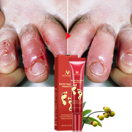 🦶 SAY GOODBYE TO DRY, CRACKED, PAINFUL FEET CREAM