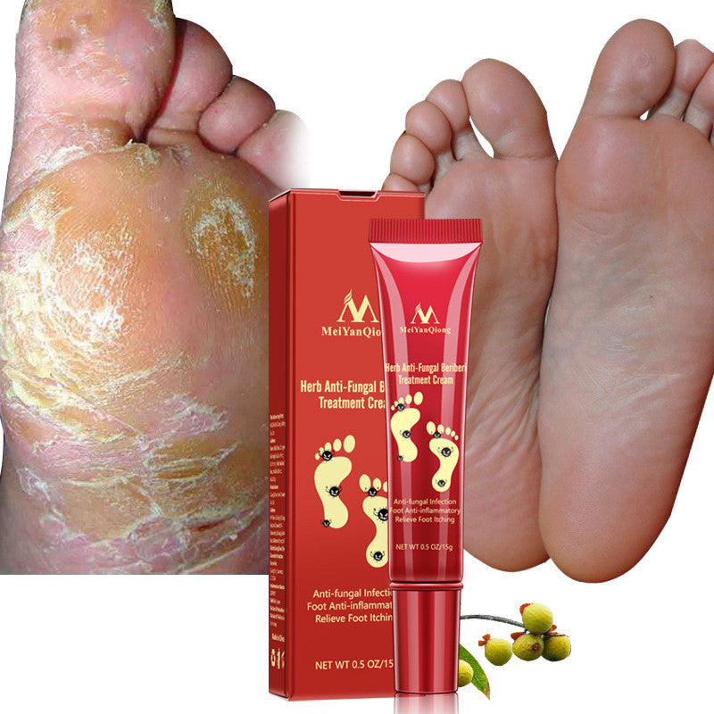 🦶 SAY GOODBYE TO DRY, CRACKED, PAINFUL FEET CREAM