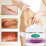 Skin Rebound Scarless Cream Scar Removal Cream Face Cream For Face Acne Scar Stretch Marks Skin Repair Face Cream