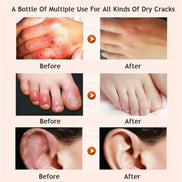 Honey Moisturizing cream foot cream leg cream