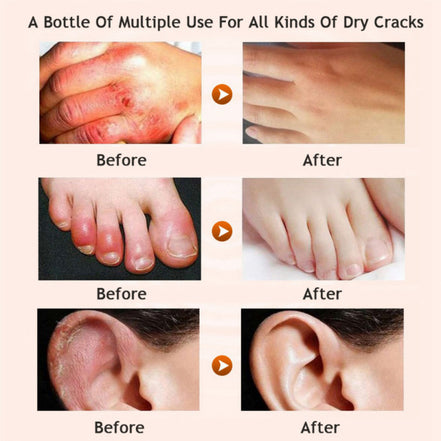 Honey Moisturizing cream foot cream leg cream