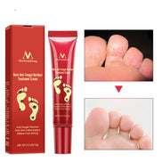 🦶 SAY GOODBYE TO DRY, CRACKED, PAINFUL FEET CREAM