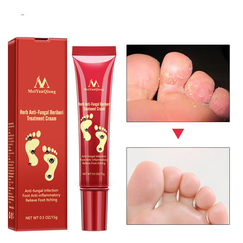 🦶 SAY GOODBYE TO DRY, CRACKED, PAINFUL FEET CREAM