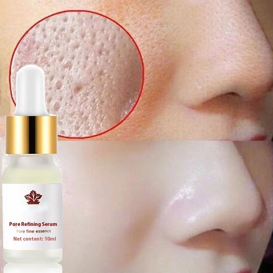 🌿 Pore Refining Serum