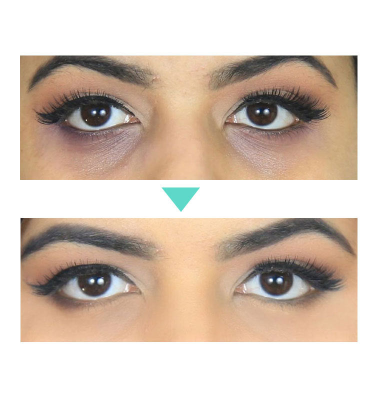 🧴AgeLift™ Peptide Eye Cream (30ML)
