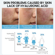 💧HydraGlow Hyaluronic Acid Face Serum – Anti-Aging, Deep Hydration & Pore Refining Skin Booster