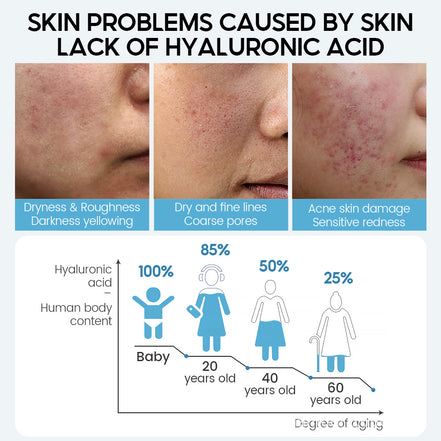 💧HydraGlow Hyaluronic Acid Face Serum – Anti-Aging, Deep Hydration & Pore Refining Skin Booster