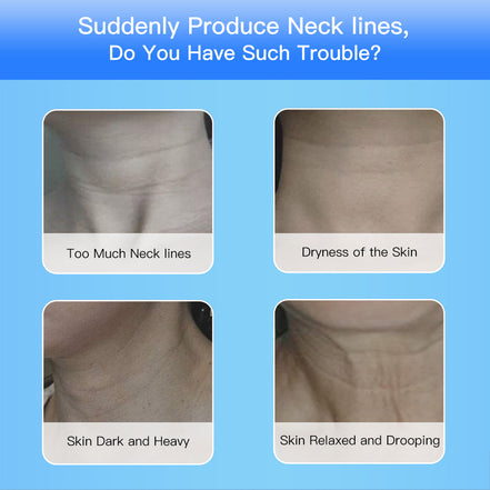 💎EMS Microcurrent Neck & Face Lifting Device – 3 Color LED Photon Therapy for Skin Tightening, Jawline Sculpting & Double Chin Appearance Reduction