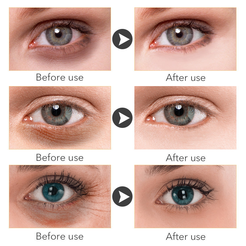 🧴AgeLift™ Peptide Eye Cream (30ML)