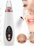 🏷️SETUP PoreLift™ Blackhead Vacuum Pro – Deep Clean, Zero Squeeze Technology