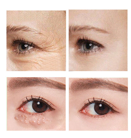 🧴AgeLift™ Peptide Eye Cream (30ML)